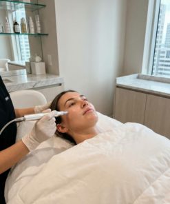 Microneedling (60min)